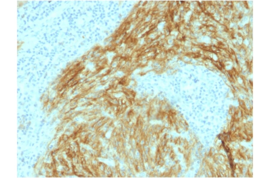 Immunohistochemistry - Anti-CD21 Antibody [CR2/1952] - BSA and Azide free (A251445) - Antibodies.com
