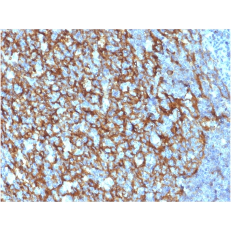 Immunohistochemistry - Anti-CD21 Antibody [CR2/1952] - BSA and Azide free (A251445) - Antibodies.com
