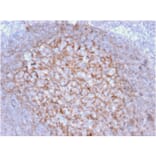 Immunohistochemistry - Anti-CD21 Antibody [CR2/1953] - BSA and Azide free (A251446) - Antibodies.com
