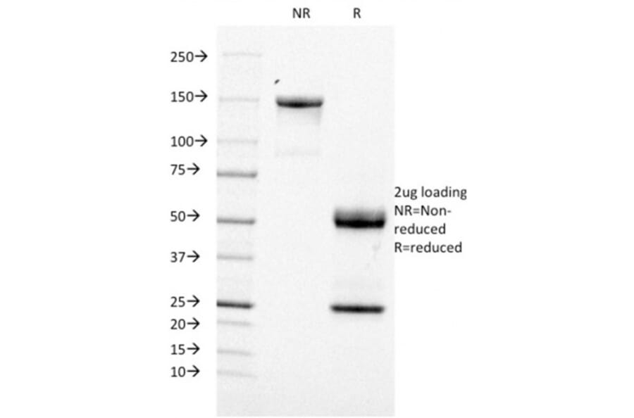 SDS-PAGE - Anti-CD21 Antibody [CR2/1953] - BSA and Azide free (A251446) - Antibodies.com