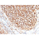 Immunohistochemistry - Anti-CD21 Antibody [CR2/2754] - BSA and Azide free (A251447) - Antibodies.com