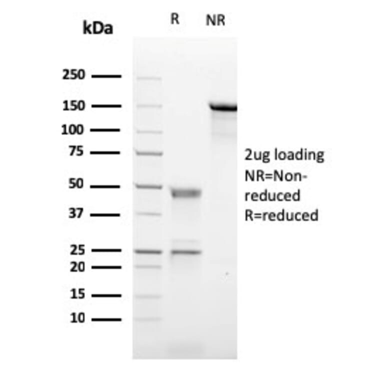 SDS-PAGE - Anti-CD21 Antibody [CR2/2754] - BSA and Azide free (A251447) - Antibodies.com