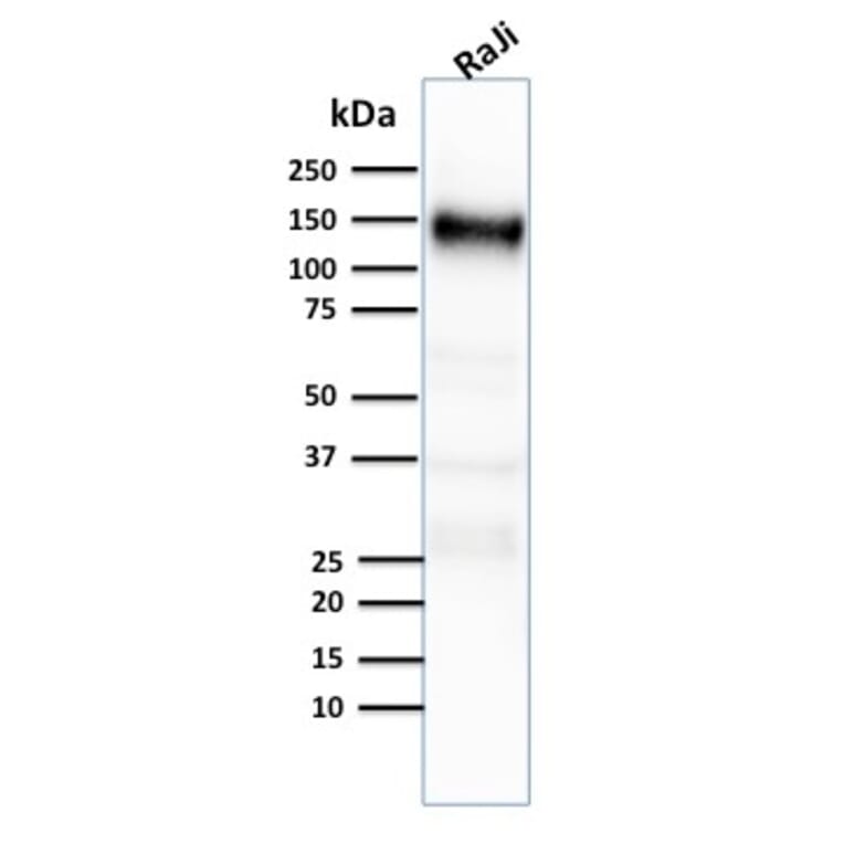 Western Blot - Anti-CD21 Antibody [CR2/2754] - BSA and Azide free (A251447) - Antibodies.com