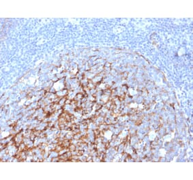 Immunohistochemistry - Anti-CD21 Antibody [CR2/3247] - BSA and Azide free (A251448) - Antibodies.com