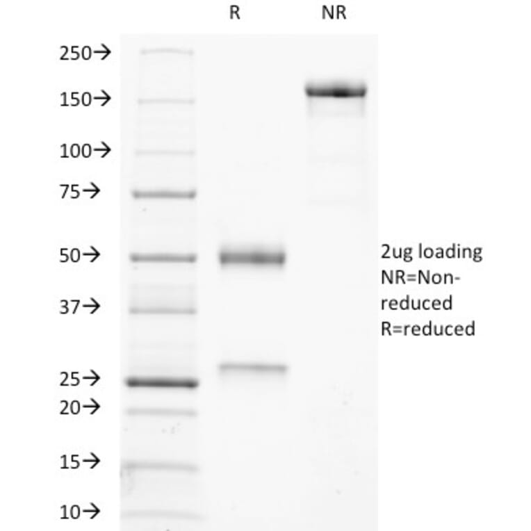 SDS-PAGE - Anti-CD21 Antibody [CR2/3247] - BSA and Azide free (A251448) - Antibodies.com