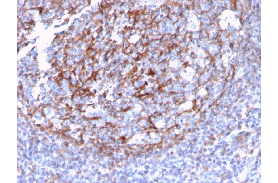 Immunohistochemistry - Anti-CD21 Antibody [CR2/3124R] - BSA and Azide free (A251449) - Antibodies.com