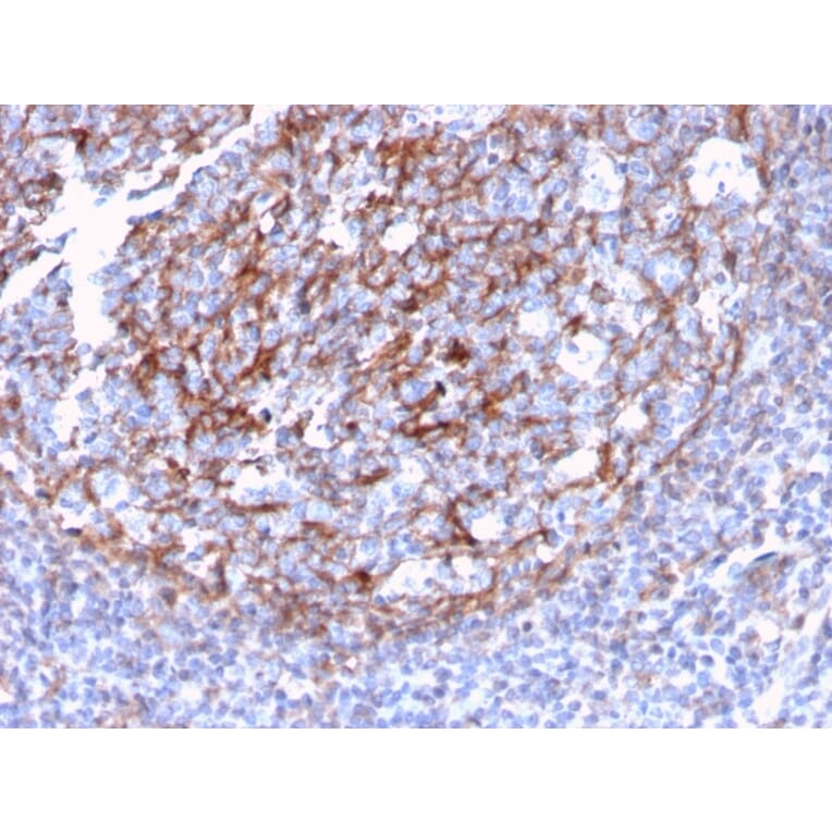 Immunohistochemistry - Anti-CD21 Antibody [CR2/3124R] - BSA and Azide free (A251449) - Antibodies.com