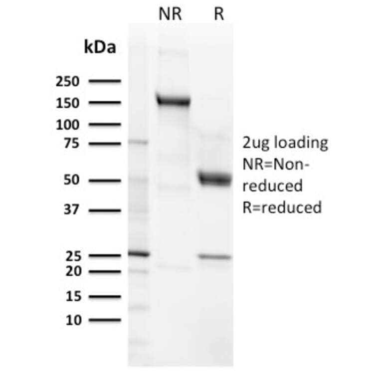 SDS-PAGE - Anti-CD21 Antibody [CR2/3124R] - BSA and Azide free (A251449) - Antibodies.com