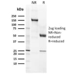 SDS-PAGE - Anti-CD21 Antibody [CR2/3124R] - BSA and Azide free (A251449) - Antibodies.com