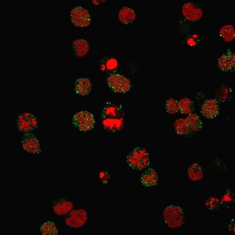 Immunofluorescence - Anti-CD21 Antibody [CR2/3124R] - BSA and Azide free (A251449) - Antibodies.com