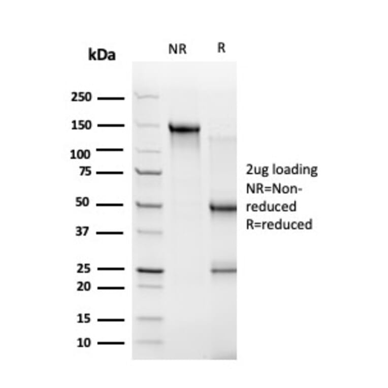 SDS-PAGE - Anti-ZBTB46 Antibody [PCRP-ZBTB46-2B8] - BSA and Azide free (A251450) - Antibodies.com