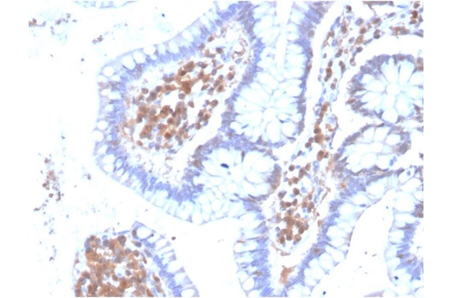 Immunohistochemistry - Anti-MAPK14 Antibody [CPTC-MAPK14-1] - BSA and Azide free (A251452) - Antibodies.com