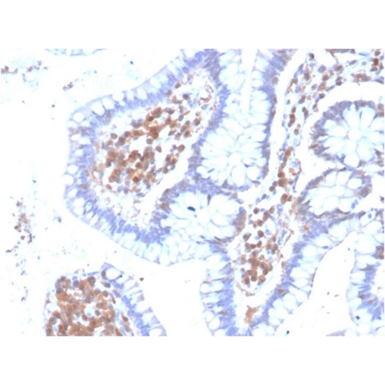 Immunohistochemistry - Anti-MAPK14 Antibody [CPTC-MAPK14-1] - BSA and Azide free (A251452) - Antibodies.com