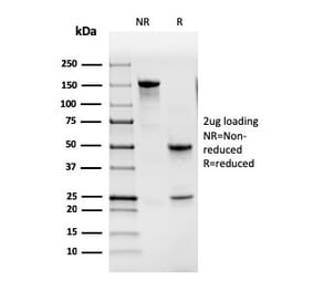 SDS-PAGE - Anti-GM-CSF Antibody [CSF2/3402] - BSA and Azide free (A251453) - Antibodies.com