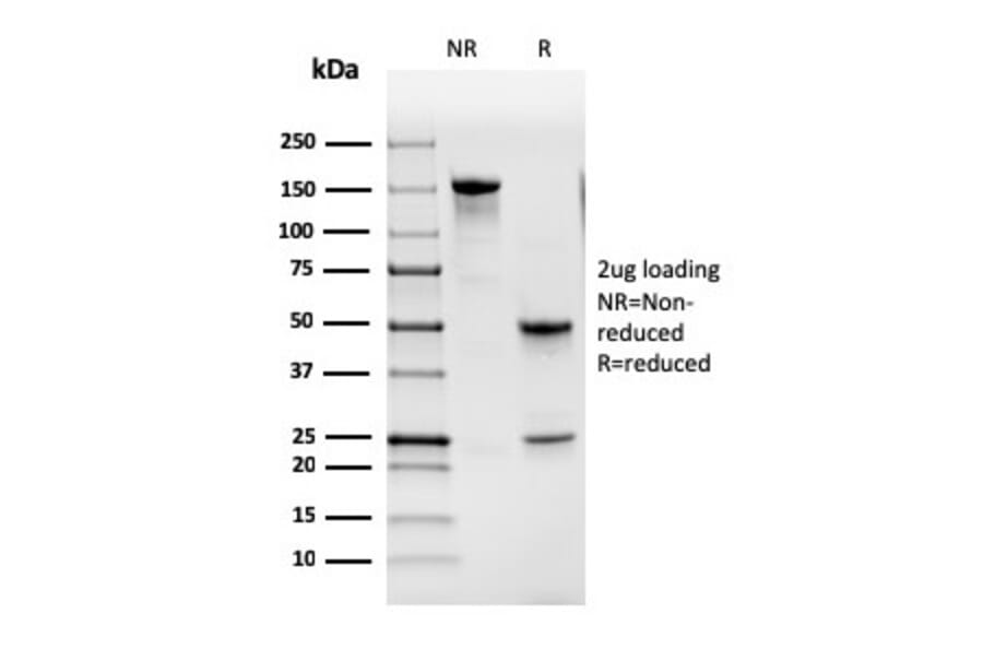 SDS-PAGE - Anti-GM-CSF Antibody [CSF2/3402] - BSA and Azide free (A251453) - Antibodies.com