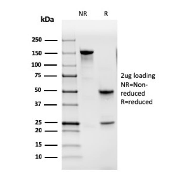 SDS-PAGE - Anti-GM-CSF Antibody [CSF2/3402] - BSA and Azide free (A251453) - Antibodies.com