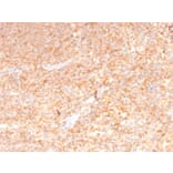 Immunohistochemistry - Anti-GM-CSF Antibody [CSF2/3402] - BSA and Azide free (A251453) - Antibodies.com