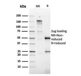 SDS-PAGE - Anti-GM-CSF Antibody [CSF2/3403] - BSA and Azide free (A251454) - Antibodies.com