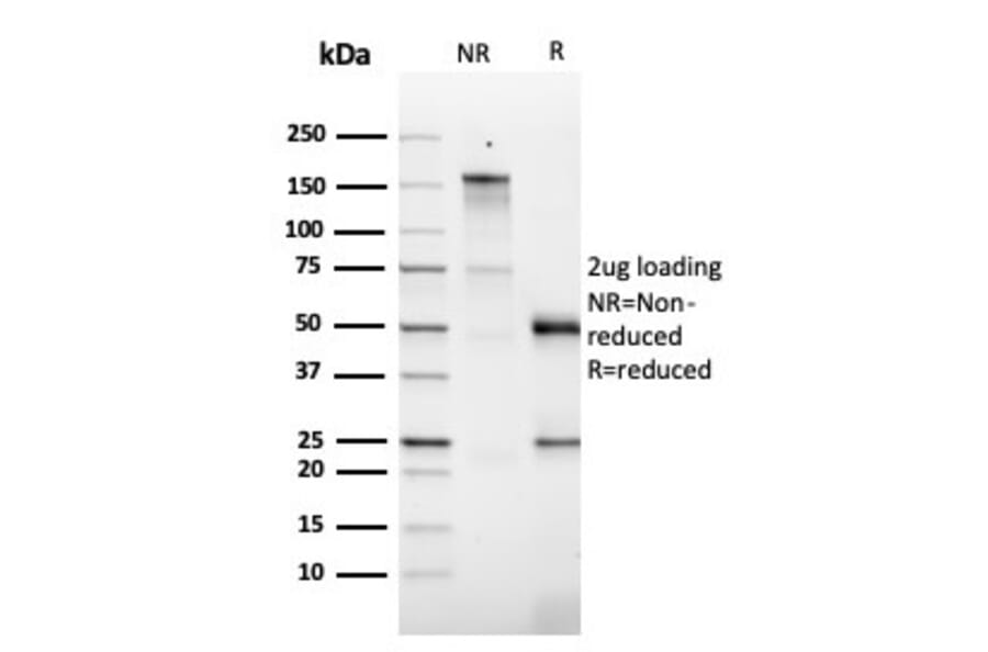 SDS-PAGE - Anti-GM-CSF Antibody [CSF2/3403] - BSA and Azide free (A251454) - Antibodies.com