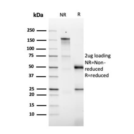 SDS-PAGE - Anti-GM-CSF Antibody [CSF2/3403] - BSA and Azide free (A251454) - Antibodies.com