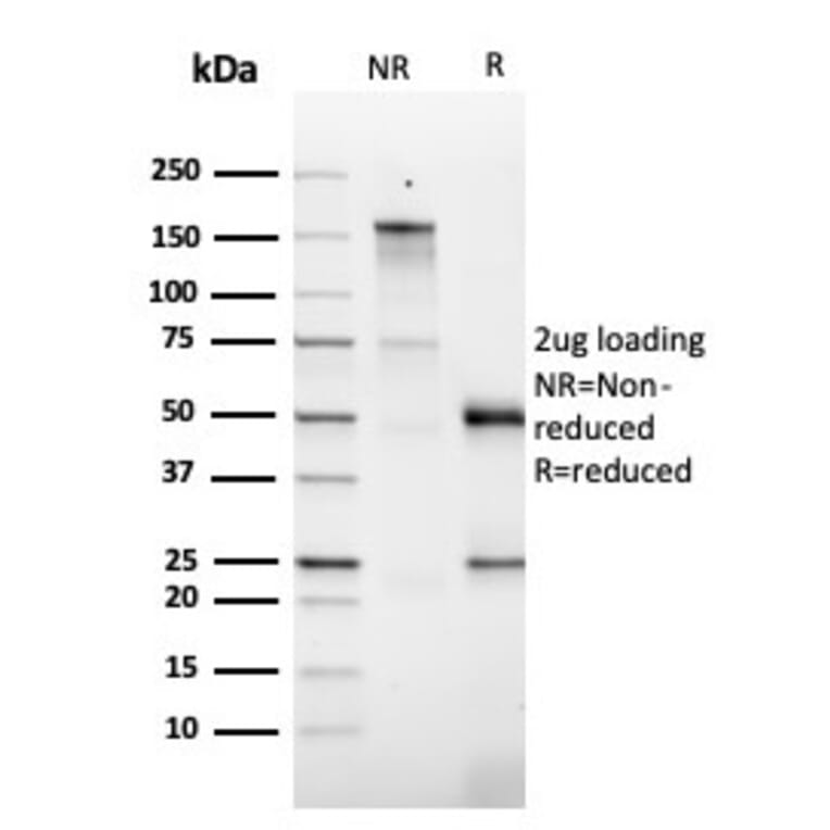 SDS-PAGE - Anti-GM-CSF Antibody [CSF2/3403] - BSA and Azide free (A251454) - Antibodies.com
