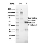 SDS-PAGE - Anti-GM-CSF Antibody [CSF2/3403] - BSA and Azide free (A251454) - Antibodies.com