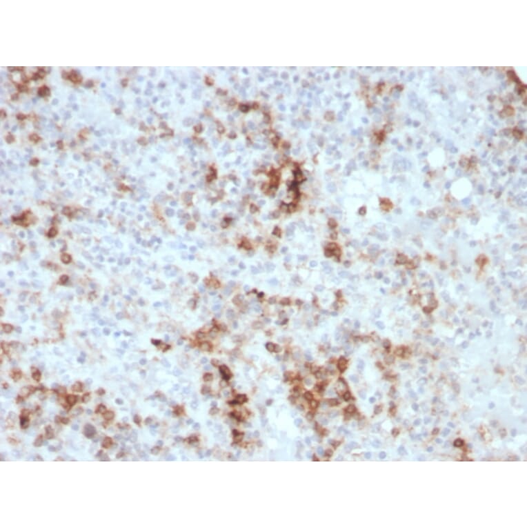 Immunohistochemistry - Anti-GM-CSF Antibody [CSF2/3403] - BSA and Azide free (A251454) - Antibodies.com