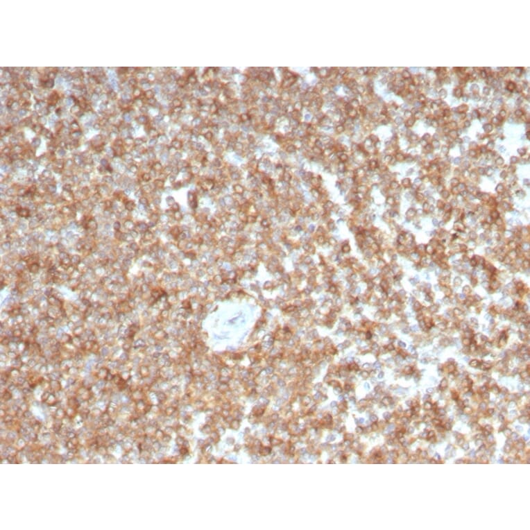 Immunohistochemistry - Anti-GM-CSF Antibody [CSF2/3403] - BSA and Azide free (A251454) - Antibodies.com