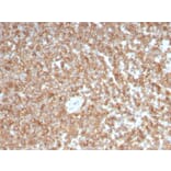 Immunohistochemistry - Anti-GM-CSF Antibody [CSF2/3403] - BSA and Azide free (A251454) - Antibodies.com