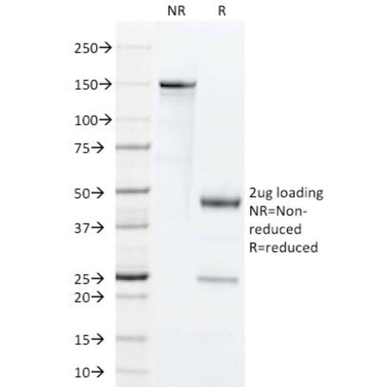 SDS-PAGE - Anti-GM-CSF Antibody [BVD2-21C11] - BSA and Azide free (A251454) - Antibodies.com