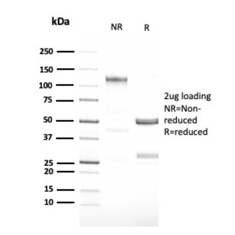 SDS-PAGE - Anti-G-CSF Antibody [CSF3/3166R] - BSA and Azide free (A251460) - Antibodies.com