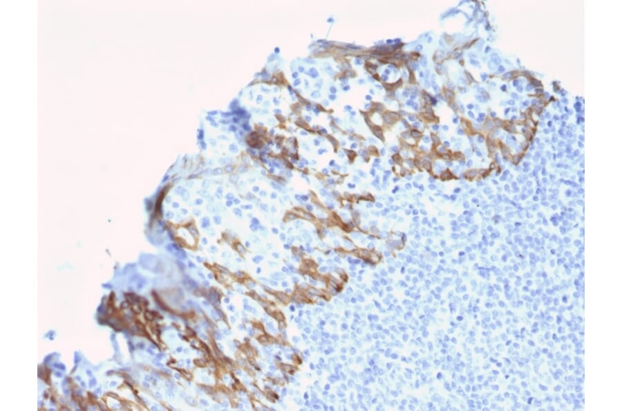 Immunohistochemistry - Anti-ZNF690 Antibody [ZSCAN29/2610] - BSA and Azide free (A251461) - Antibodies.com