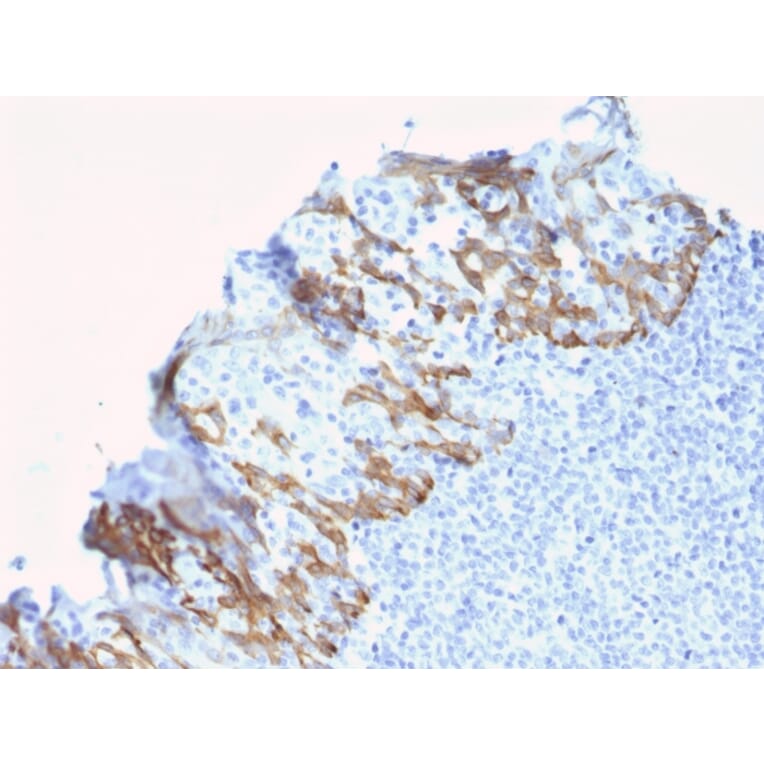 Immunohistochemistry - Anti-ZNF690 Antibody [ZSCAN29/2610] - BSA and Azide free (A251461) - Antibodies.com