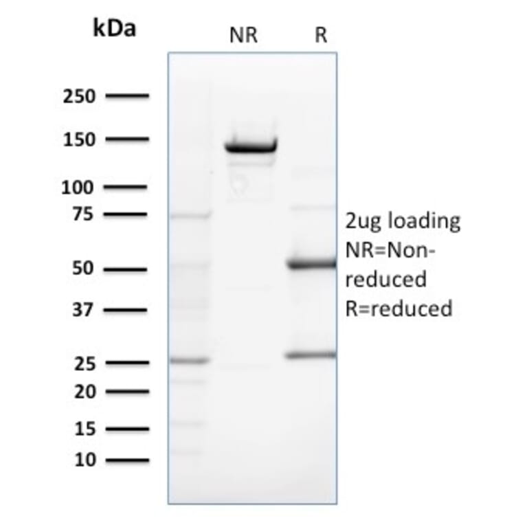 SDS-PAGE - Anti-ZNF690 Antibody [ZSCAN29/2610] - BSA and Azide free (A251461) - Antibodies.com