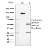 SDS-PAGE - Anti-ZNF690 Antibody [ZSCAN29/2610] - BSA and Azide free (A251461) - Antibodies.com