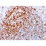 Immunohistochemistry - Anti-Cystatin A Antibody [CPTC-CSTA-1] - BSA and Azide free (A251463) - Antibodies.com