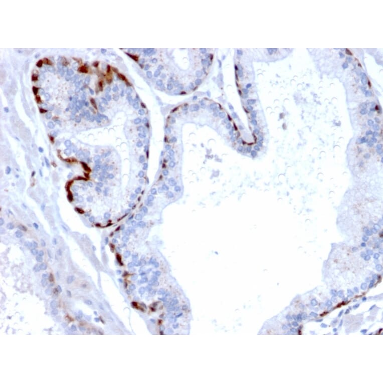 Immunohistochemistry - Anti-Cystatin A Antibody [CPTC-CSTA-1] - BSA and Azide free (A251461) - Antibodies.com