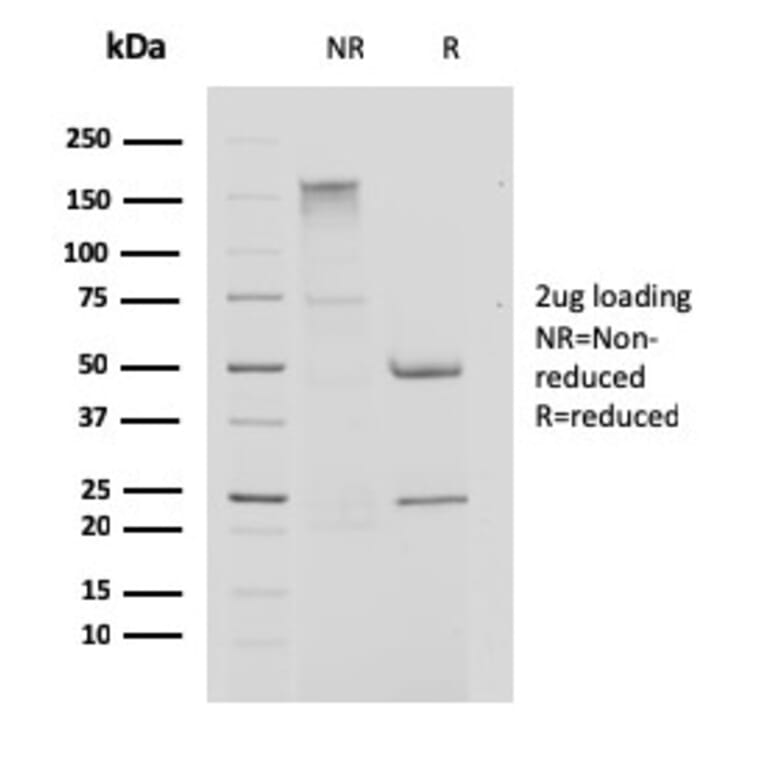 SDS-PAGE - Anti-Cystatin A Antibody [CPTC-CSTA-1] - BSA and Azide free (A251463) - Antibodies.com