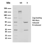 SDS-PAGE - Anti-Cystatin A Antibody [CPTC-CSTA-1] - BSA and Azide free (A251463) - Antibodies.com