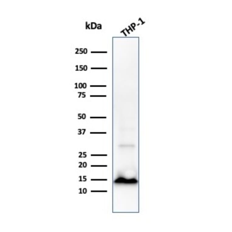 Western Blot - Anti-Cystatin A Antibody [CPTC-CSTA-1] - BSA and Azide free (A251463) - Antibodies.com