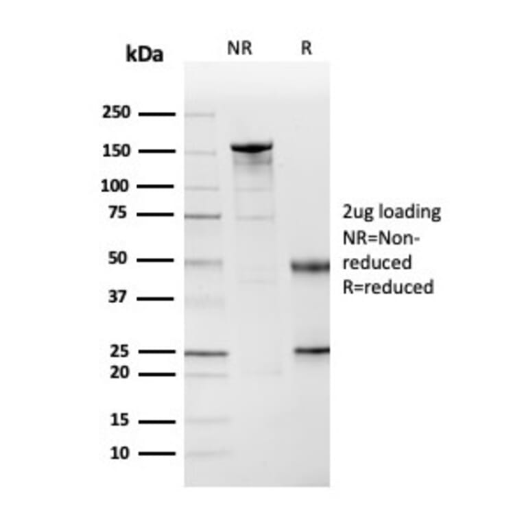 SDS-PAGE - Anti-Cystatin A Antibody [CSTA/3553] - BSA and Azide free (A251465) - Antibodies.com