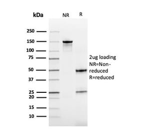 SDS-PAGE - Anti-Cystatin B Antibody [CPTC-CSTB-3] - BSA and Azide free (A251466) - Antibodies.com