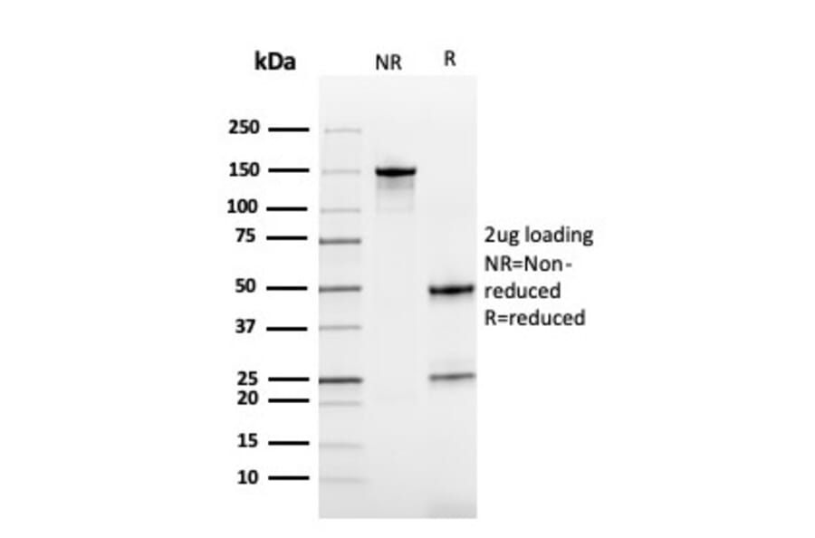 SDS-PAGE - Anti-Cystatin B Antibody [CPTC-CSTB-3] - BSA and Azide free (A251466) - Antibodies.com
