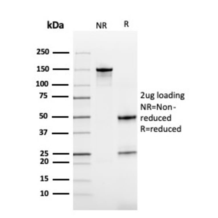 SDS-PAGE - Anti-Cystatin B Antibody [CPTC-CSTB-3] - BSA and Azide free (A251466) - Antibodies.com