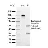 SDS-PAGE - Anti-Cystatin B Antibody [CPTC-CSTB-3] - BSA and Azide free (A251466) - Antibodies.com