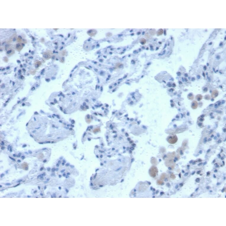 Immunohistochemistry - Anti-Cystatin B Antibody [CPTC-CSTB-3] - BSA and Azide free (A251465) - Antibodies.com