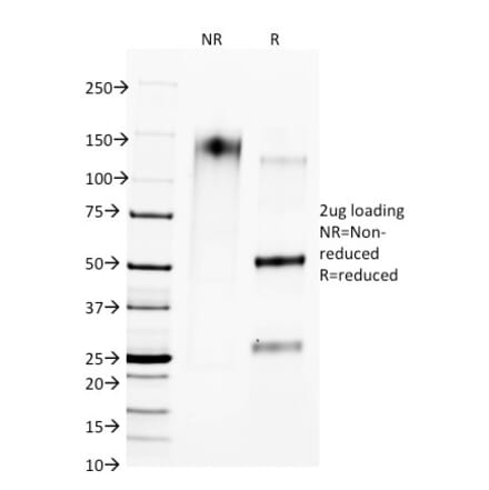 SDS-PAGE - Anti-CTLA4 Antibody [L4P2F5.F10] - BSA and Azide free (A251468) - Antibodies.com