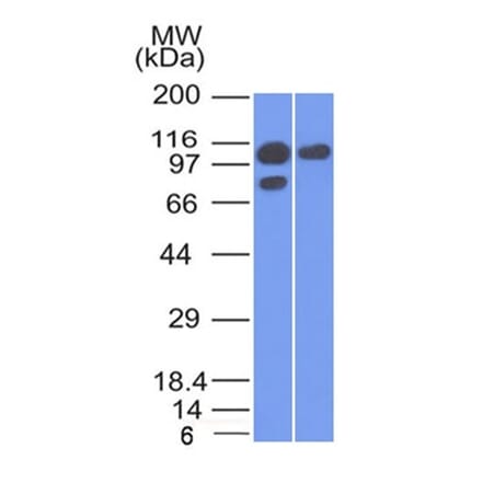 Western Blot - Anti-alpha 1 Catenin Antibody [1G5] - BSA and Azide free (A251470) - Antibodies.com