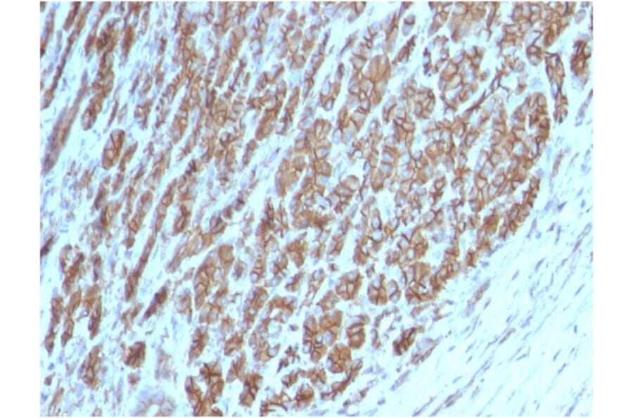 Immunohistochemistry - Anti-beta Catenin Antibody [CTNNB1/2098] - BSA and Azide free (A251471) - Antibodies.com