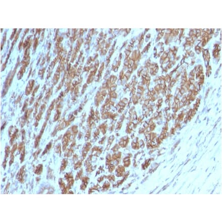 Immunohistochemistry - Anti-beta Catenin Antibody [CTNNB1/2098] - BSA and Azide free (A251471) - Antibodies.com